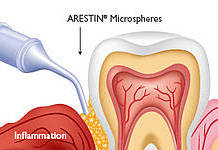 Periodontal_Therapy2